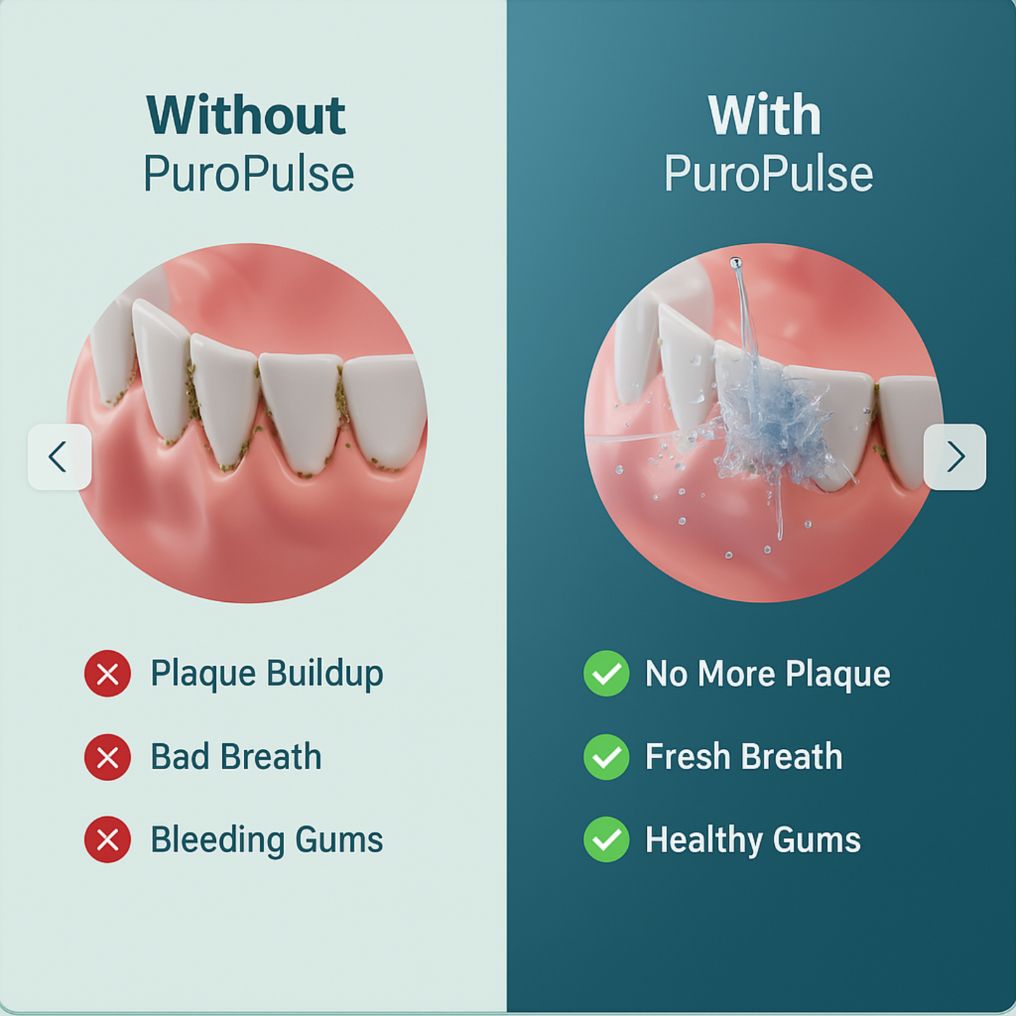 PuroPulse Water Flosser
