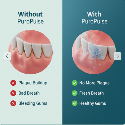 PuroPulse Water Flosser